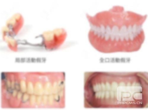 拔牙之后多久可以種植牙?,齒,做種植牙 拔牙之后多久可以種植牙?,齒,做種植牙