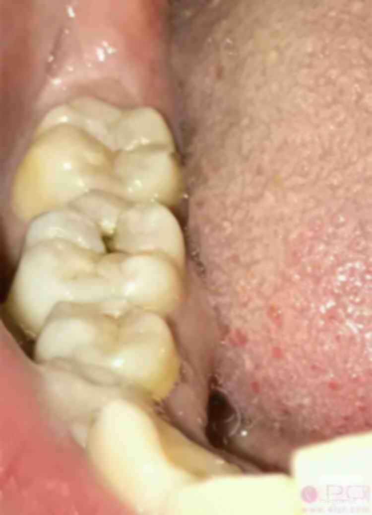 拜博口腔哪个医生好,医院怎么样?和英博口腔哪家好? 拜博口腔哪个医生好,医院怎么样?和英博口腔哪家好?