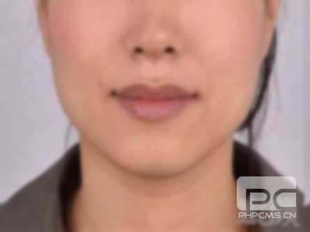 隐适美能矫正龅牙吗?牙齿,整牙效果好吗? 隐适美能矫正龅牙吗?牙齿,整牙效果好吗?