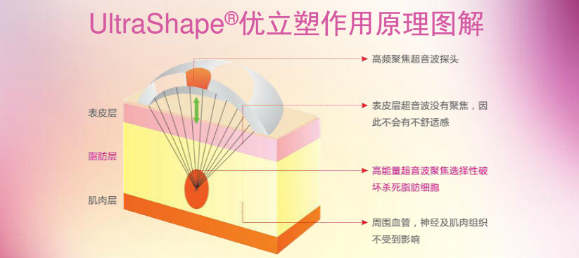 優(yōu)立塑溶脂減肥原理