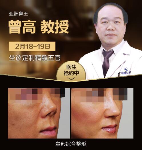 亞洲鼻王曾高教授做鼻綜合整形后效果對比圖