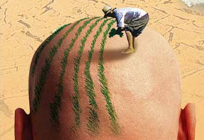 壹加壹植發(fā)是將后腦勺部位的健康毛囊提取一小部分，移植到脫發(fā)部位，移植過(guò)來(lái)的頭發(fā)基本可以健康生長(zhǎng)。