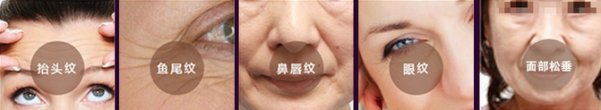 面部皮膚出現(xiàn)松弛、下垂，額頭，嘴角布滿皺紋怎么辦
