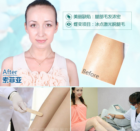 外国模特索菲亚，脱毛后美腿更迷人