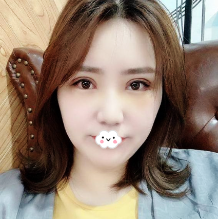 <i data-id=5aa56272-0650-4adb-9105-9dd1b87e313b></i><i data-id=f57ef070-ff71-4bf5-8f35-7da113fe09cc></i>做双眼皮修复怎么样