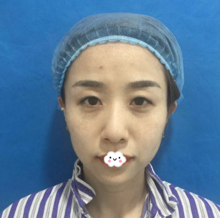 <i data-id=d97e4539-b925-4bef-a5cd-fd27da47fa04></i>整形醫(yī)院誰(shuí)做眼睛好？除了<i data-id=7ade8233-18e0-40a7-8865-313b41366502></i>之外桂行軍醫(yī)生做的雙眼皮眼綜合也很出名哦