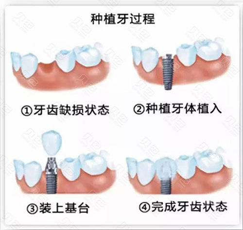 深圳龍華區(qū)口腔醫(yī)院排名榜,深圳龍華區(qū)去哪看牙科性價比超高?