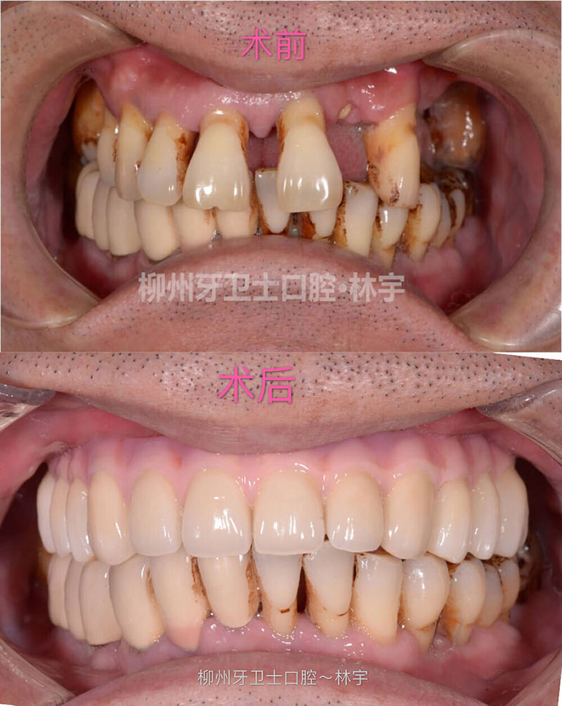 上海金山區(qū)烤瓷牙哪家醫(yī)院做的不錯(cuò)?中博口腔、鵬翔口腔、美萊口腔等醫(yī)院技術(shù)實(shí)力超群