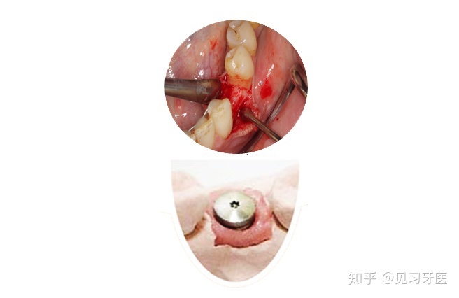 南阳十大热门牙科医院权威榜单整理汇总:精益口腔入选权威榜单,详解各家医院特点 南阳十大热门牙科医院权威榜单整理汇总:精益口腔入选权威榜单,详解各家医院特点