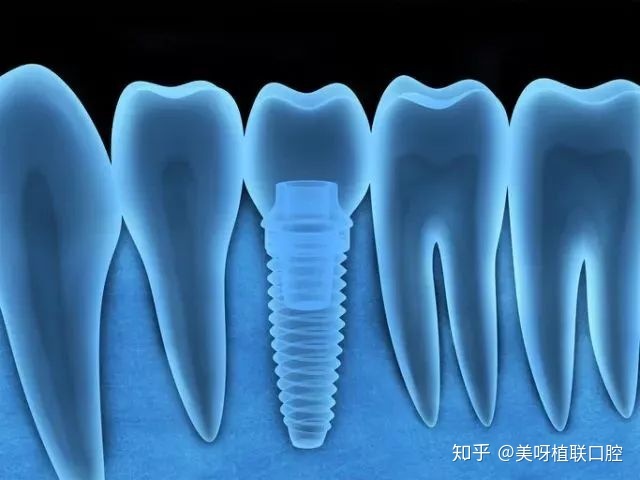咸宁牙科医院排名榜单权威公布,湖北科技学院口腔医院、、【医院】等便宜质量好 咸宁牙科医院排名榜单权威公布,湖北科技学院口腔医院、、【医院】等便宜质量好