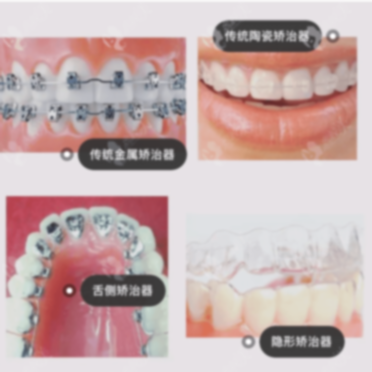拜博口腔和英博口腔哪家好?,哪個醫(yī)生好, 怎么樣?