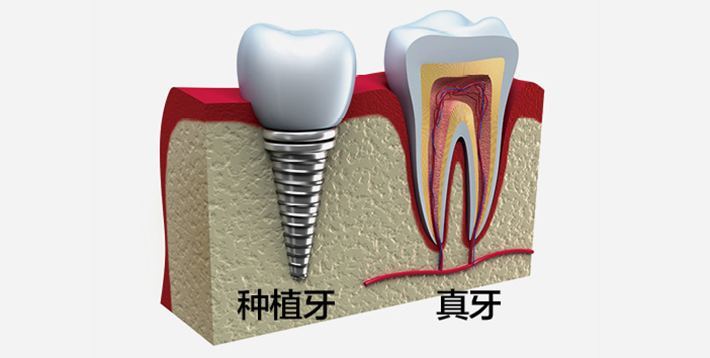 上海嘉定區(qū)口腔醫(yī)院價(jià)目表權(quán)威發(fā)布!內(nèi)含烤瓷牙|種植牙|牙齒矯正