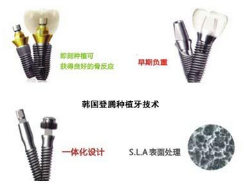上海嘉定區(qū)口腔醫(yī)院新版價格表!烤瓷牙|種植牙|牙齒矯正都在這兒