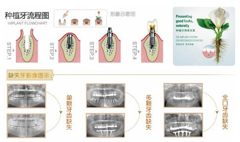 新版上海口腔醫(yī)院收費表重磅揭露,快去收藏起來！