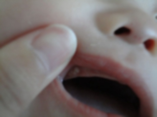 八個月門牙縫隙大,寶寶八個月門牙縫隙大,寶寶乳牙縫隙大 八個月門牙縫隙大,寶寶八個月門牙縫隙大,寶寶乳牙縫隙大