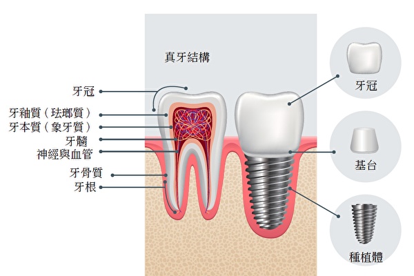 深圳寶安區(qū)口腔醫(yī)院價(jià)目表權(quán)威公布,深圳寶安區(qū)牙齒矯正醫(yī)院收費(fèi)標(biāo)準(zhǔn)都在這里