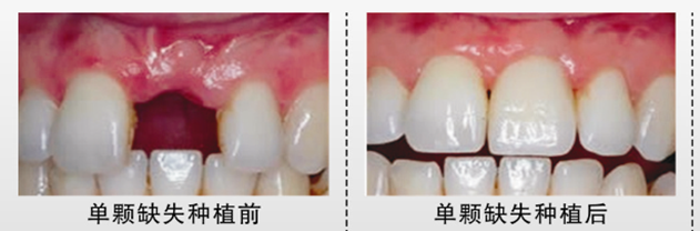 向你收集整理广州增城区牙科医院重点十家重点排名，致美、三仁口腔名单出炉！