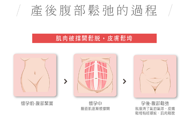 选择腹部拉皮手术注意事项