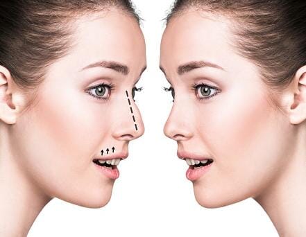 下颌角外科术后的护理要点，记住这四点，整张脸不够精致