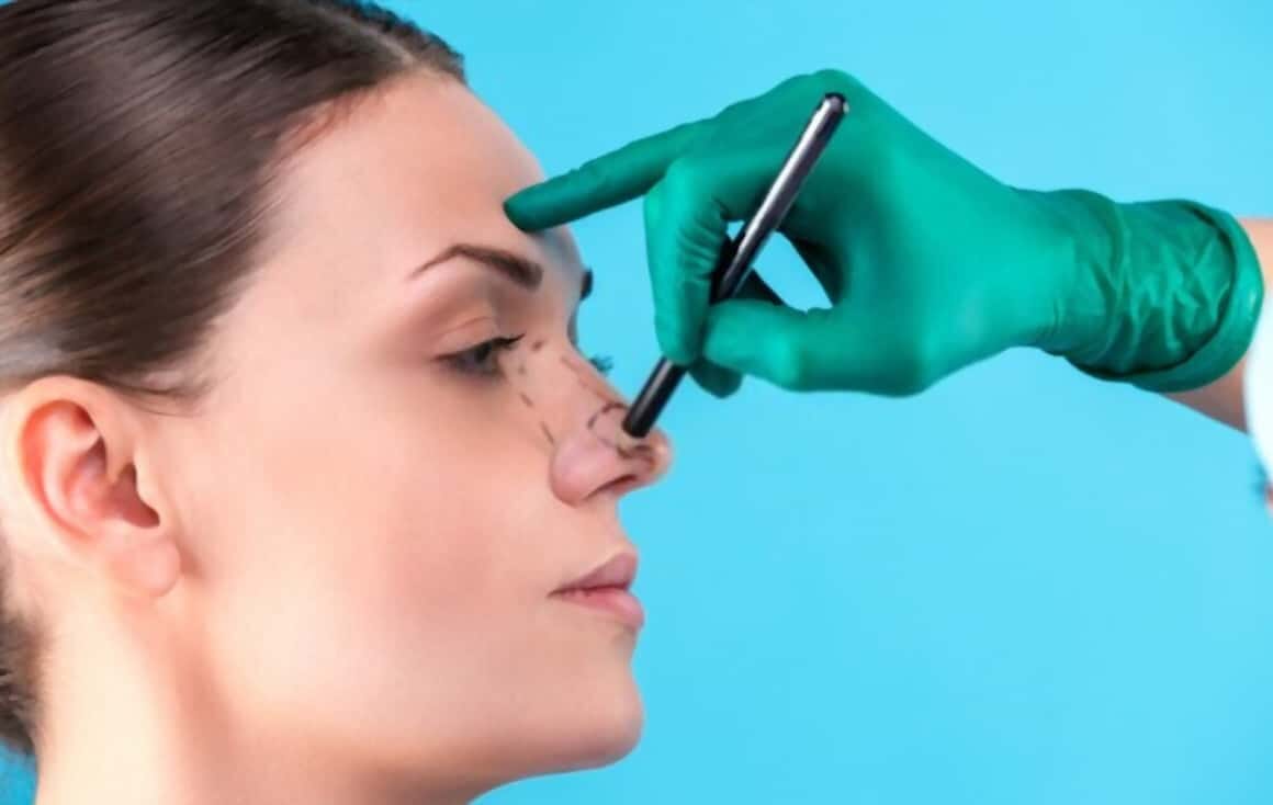 怎样才能进行鼻部整形手术，怎样才能进行鼻整形手术